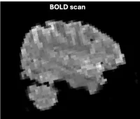 pixelated image of the brain