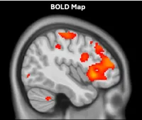 brain image with areas of high activity colored in warm colors